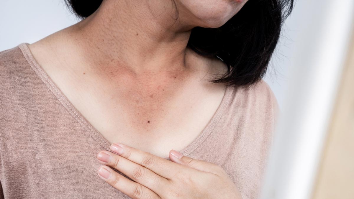 How To Get Rid Of Dark Neck At Home